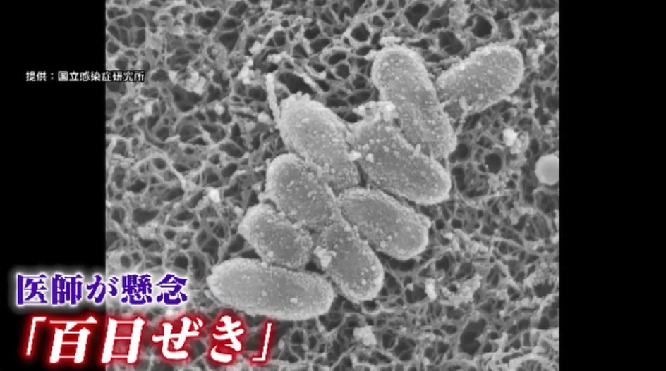 猛威振るう「百日ぜき」…GW後の今の時期が特に注意　一般的な抗菌薬が効かない例も　県内の感染者はすでに去年の4倍超　福岡